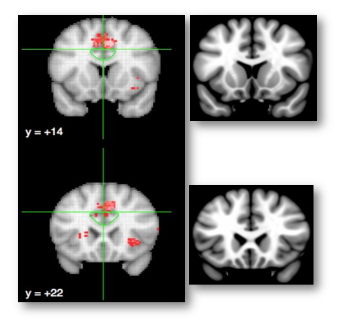 figure11